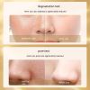Luxury Five-piece Set For Skin Care with Retinol